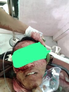 Mayat Pria Misterius Ditemukan di Sampang, Tangan Terikat dan Penuh Luka: Polisi Selidiki Dugaan Pembunuhan Sadis